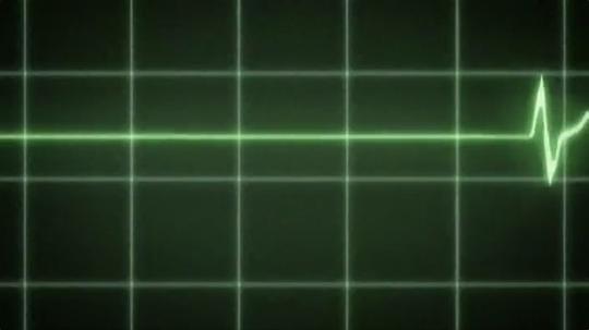 妄想代理人 剧照